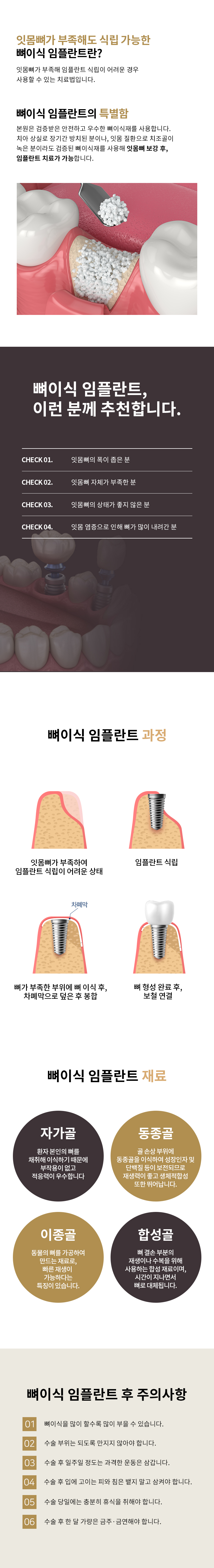 시니어 임플란트